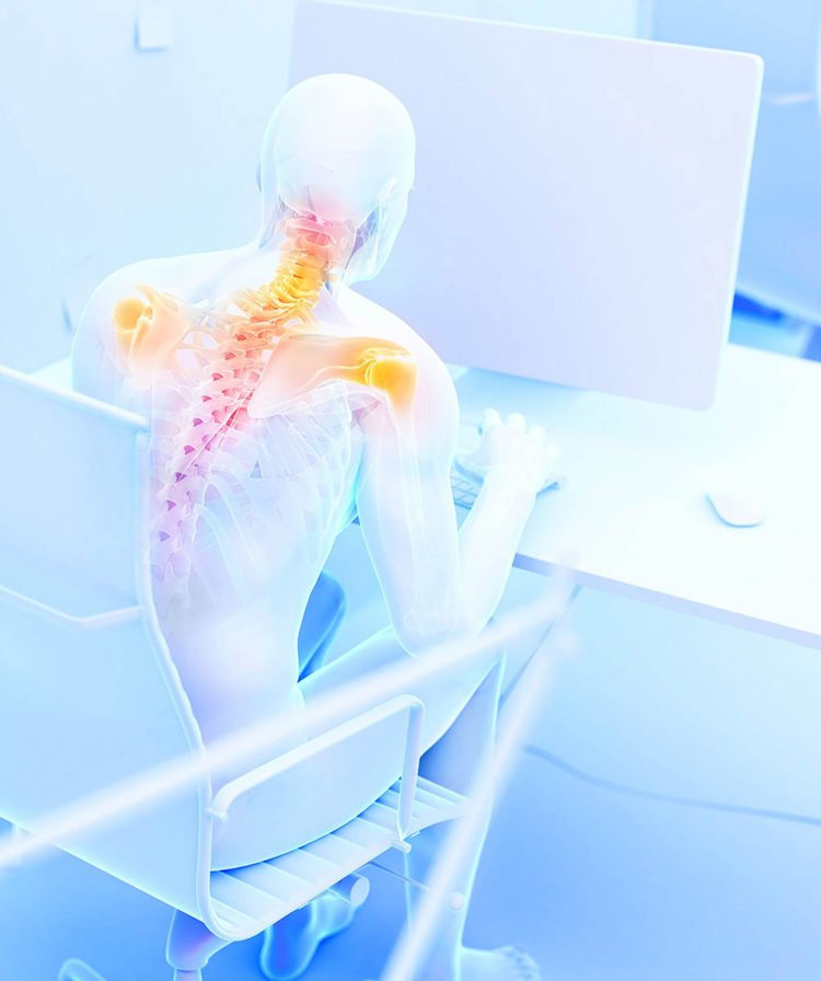 bad posture illustration